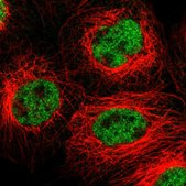 Anti-FZD10 antibody produced in rabbit Prestige Antibodies® Powered by Atlas Antibodies, affinity isolated antibody, buffered aqueous glycerol solution