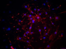 YUMM 1.3 Mouse Melanoma Cell Line