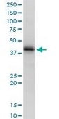 Anti-HLA-A antibody produced in mouse purified immunoglobulin, buffered aqueous solution