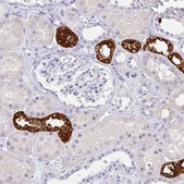 Anti-UMOD antibody produced in rabbit Prestige Antibodies® Powered by Atlas Antibodies, affinity isolated antibody, buffered aqueous glycerol solution
