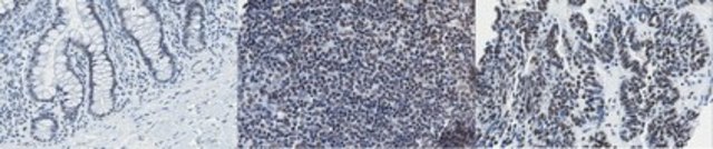 Anti-NCoA-2 Antibody, clone 1C6.3 clone 1C6.3, from mouse