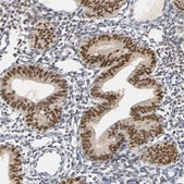 Anti-PGR antibody produced in rabbit Ab1, Prestige Antibodies® Powered by Atlas Antibodies, affinity isolated antibody, buffered aqueous glycerol solution