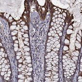 Anti-CEACAM7 antibody produced in rabbit Prestige Antibodies® Powered by Atlas Antibodies, affinity isolated antibody, buffered aqueous glycerol solution