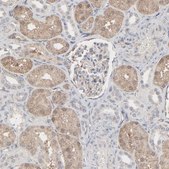 Anti-JAM3 antibody produced in rabbit Prestige Antibodies® Powered by Atlas Antibodies, affinity isolated antibody, buffered aqueous glycerol solution