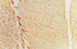 Anti-Glutamate Decarboxylase 65 &amp; 67 Antibody Chemicon®, from rabbit