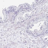 Anti-SRL antibody produced in rabbit Prestige Antibodies® Powered by Atlas Antibodies, affinity isolated antibody, buffered aqueous glycerol solution