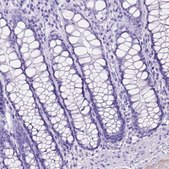 Anti-ITIH4 antibody produced in rabbit Ab2, Prestige Antibodies® Powered by Atlas Antibodies, affinity isolated antibody, buffered aqueous glycerol solution