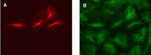 LentiBrite RFP-Vimentin Lentiviral Biosensor