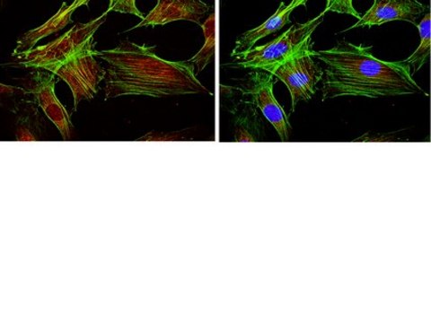 Anti-FOXO1 Antibody, clone 2H8.2 clone 2H8.2, from mouse