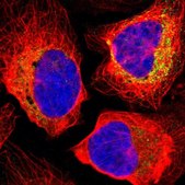 Anti-TIMM8A antibody produced in rabbit Prestige Antibodies® Powered by Atlas Antibodies, affinity isolated antibody, buffered aqueous glycerol solution