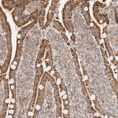 Anti-NDUFB11 antibody produced in rabbit Prestige Antibodies® Powered by Atlas Antibodies, affinity isolated antibody, buffered aqueous glycerol solution