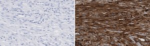 Anti-β-Actin Antibody, clone 6L12, ZooMAb® Rabbit Monoclonal recombinant, expressed in HEK 293 cells