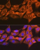 Anti-SOCS2 antibody produced in rabbit