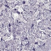 Anti-TSPYL5 antibody produced in rabbit Prestige Antibodies® Powered by Atlas Antibodies, affinity isolated antibody, buffered aqueous glycerol solution