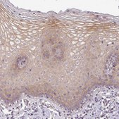 Anti-SLC16A9 antibody produced in rabbit Prestige Antibodies® Powered by Atlas Antibodies, affinity isolated antibody, buffered aqueous glycerol solution