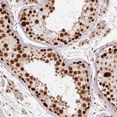 Anti-RFC4 antibody produced in rabbit Prestige Antibodies® Powered by Atlas Antibodies, affinity isolated antibody, buffered aqueous glycerol solution