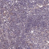 Anti-NUDT8 antibody produced in rabbit Prestige Antibodies® Powered by Atlas Antibodies, affinity isolated antibody, buffered aqueous glycerol solution
