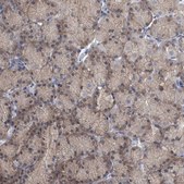 Anti-FAM83H antibody produced in rabbit Prestige Antibodies® Powered by Atlas Antibodies, affinity isolated antibody, buffered aqueous glycerol solution, Ab1