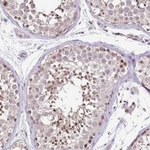 Anti-IZUMO4 antibody produced in rabbit Prestige Antibodies® Powered by Atlas Antibodies, affinity isolated antibody, buffered aqueous glycerol solution