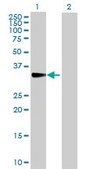 Anti-CISH antibody produced in rabbit IgG fraction of antiserum, buffered aqueous solution