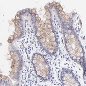 Anti-EBP antibody produced in rabbit Prestige Antibodies® Powered by Atlas Antibodies, affinity isolated antibody, buffered aqueous glycerol solution