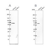 Anti-NMT1 antibody produced in rabbit Prestige Antibodies® Powered by Atlas Antibodies, affinity isolated antibody, buffered aqueous glycerol solution, Ab2