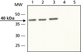 Anti-Doublecortin antibody produced in rabbit ~1 mg/mL, affinity isolated antibody, buffered aqueous solution