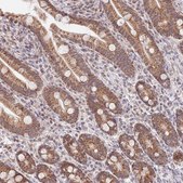 Anti-TIMM13 antibody produced in rabbit Prestige Antibodies® Powered by Atlas Antibodies, affinity isolated antibody, buffered aqueous glycerol solution