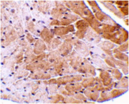 Anti-CIDE-A Antibody from rabbit, purified by affinity chromatography