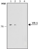 Anti-Vanilloid Receptor-1 antibody produced in rabbit IgG fraction of antiserum, buffered aqueous solution