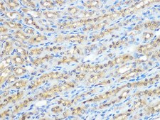Anti-PP1 beta antibody produced in rabbit