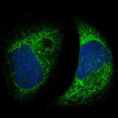 Anti-MTDH antibody produced in rabbit Ab1, Prestige Antibodies® Powered by Atlas Antibodies, affinity isolated antibody, buffered aqueous glycerol solution