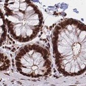 Anti-HDGF antibody produced in rabbit Prestige Antibodies® Powered by Atlas Antibodies, affinity isolated antibody, buffered aqueous glycerol solution
