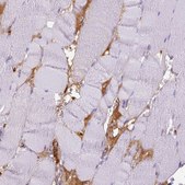 Anti-ITIH4 antibody produced in rabbit Ab2, Prestige Antibodies® Powered by Atlas Antibodies, affinity isolated antibody, buffered aqueous glycerol solution
