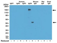 Rabbit-Anti-Human IgG4 Antibody, clone RM120 clone RM120, from rabbit