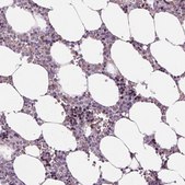 Anti-MKI67 antibody produced in rabbit Ab2, Prestige Antibodies® Powered by Atlas Antibodies, affinity isolated antibody, buffered aqueous glycerol solution