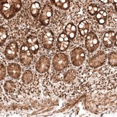 Anti-PARP14 antibody produced in rabbit Prestige Antibodies® Powered by Atlas Antibodies, affinity isolated antibody, buffered aqueous glycerol solution