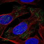 Anti-LSM6 antibody produced in rabbit Prestige Antibodies® Powered by Atlas Antibodies, affinity isolated antibody, buffered aqueous glycerol solution