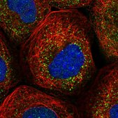 Anti-RABGGTB antibody produced in rabbit Prestige Antibodies® Powered by Atlas Antibodies, affinity isolated antibody, buffered aqueous glycerol solution, Ab1