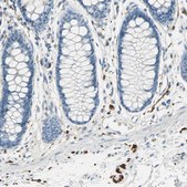 Anti-UCHL1 antibody produced in rabbit Prestige Antibodies® Powered by Atlas Antibodies, affinity isolated antibody, buffered aqueous glycerol solution