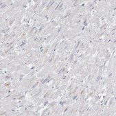 Anti-AMPD1 antibody produced in rabbit Prestige Antibodies® Powered by Atlas Antibodies, affinity isolated antibody, buffered aqueous glycerol solution, ab2