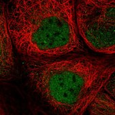 Anti-SMCR8 antibody produced in rabbit Prestige Antibodies® Powered by Atlas Antibodies, affinity isolated antibody, buffered aqueous glycerol solution, Ab2