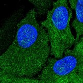Anti-AMDHD1 antibody produced in rabbit Prestige Antibodies® Powered by Atlas Antibodies, affinity isolated antibody, buffered aqueous glycerol solution