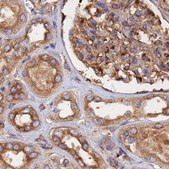 Anti-DCTN2 antibody produced in rabbit Prestige Antibodies® Powered by Atlas Antibodies, affinity isolated antibody, buffered aqueous glycerol solution