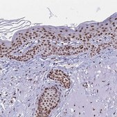 Anti-YTHDF2 antibody produced in rabbit Prestige Antibodies® Powered by Atlas Antibodies, affinity isolated antibody, buffered aqueous glycerol solution