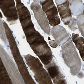 Anti-PHKG1 antibody produced in rabbit Prestige Antibodies® Powered by Atlas Antibodies, affinity isolated antibody, buffered aqueous glycerol solution