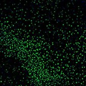 Anti-ZNF3 antibody produced in rabbit Prestige Antibodies® Powered by Atlas Antibodies, affinity isolated antibody, buffered aqueous glycerol solution