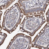 Anti-SNX7 antibody produced in rabbit Prestige Antibodies® Powered by Atlas Antibodies, affinity isolated antibody, buffered aqueous glycerol solution