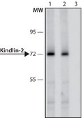 Anti-Kindlin-2 antibody produced in rabbit ~1.0 mg/mL, affinity isolated antibody, buffered aqueous solution