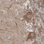 Anti-LRPPRC antibody produced in rabbit Prestige Antibodies® Powered by Atlas Antibodies, affinity isolated antibody, buffered aqueous glycerol solution